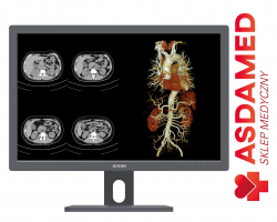 Monitory medyczne - monitory tablety radiologiczne